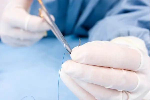 Dikiş Atma ve Alma Hizmeti